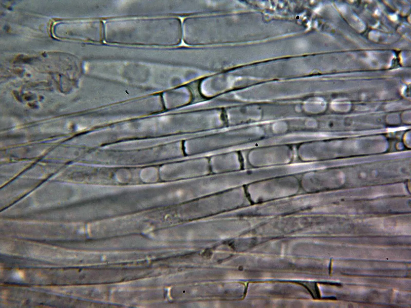 Microscopía de Neoboletus erythropus - 10 - Hifas trama
